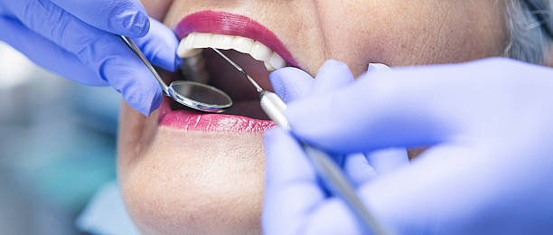 Best Emergency Dentist for Lost Fillings or Crowns in Pasadena, CA